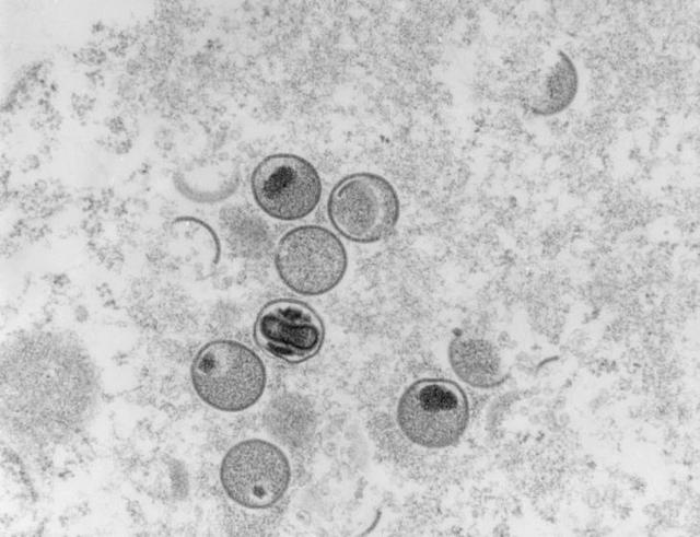 猴痘病：重庆发现1例境外输入猴痘病例